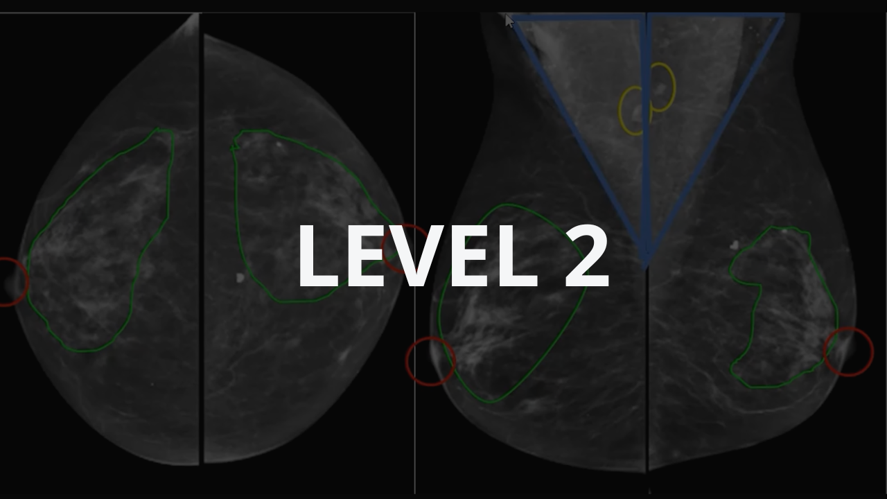 Breast Imaging Fundamentals - Level 2 - MRI Online is now